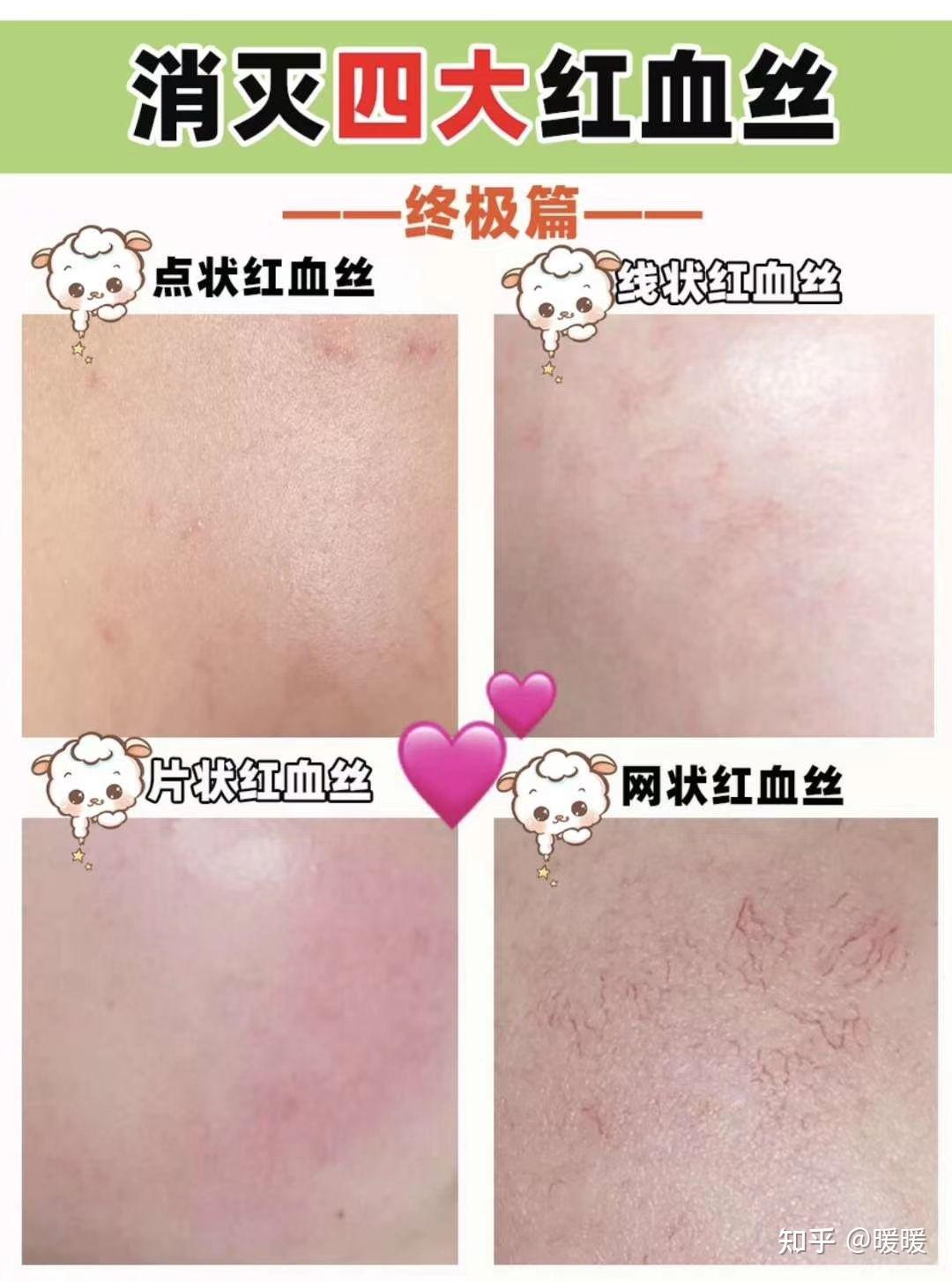 人体最大的器官养“厚”一点才好！直接影响衰老速度……